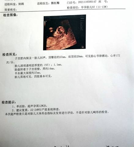 journal_insert_pic_1679159402