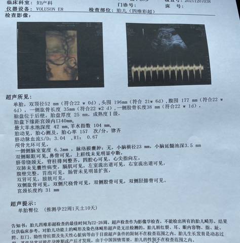 journal_insert_pic_1675535314