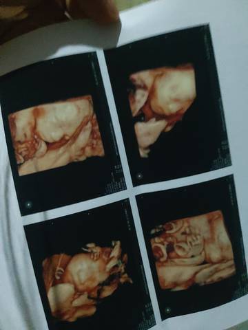 journal_insert_pic_1675063536
