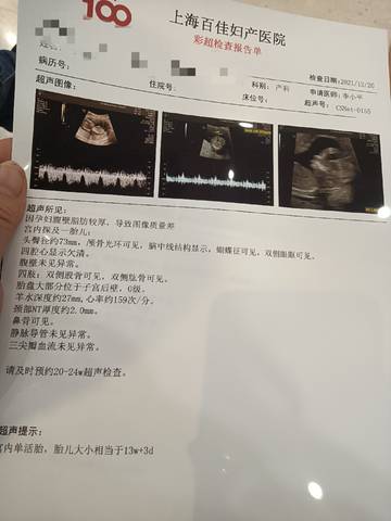 journal_insert_pic_1683070191