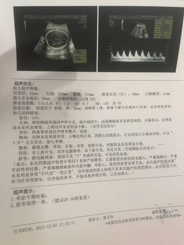 journal_insert_pic_1683695530