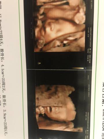 journal_insert_pic_1674056649