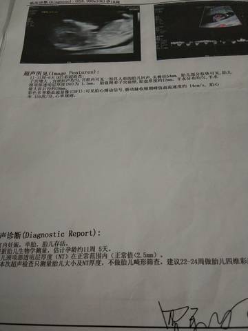 journal_insert_pic_1684326558