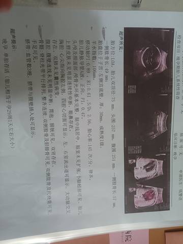 journal_insert_pic_1683757424