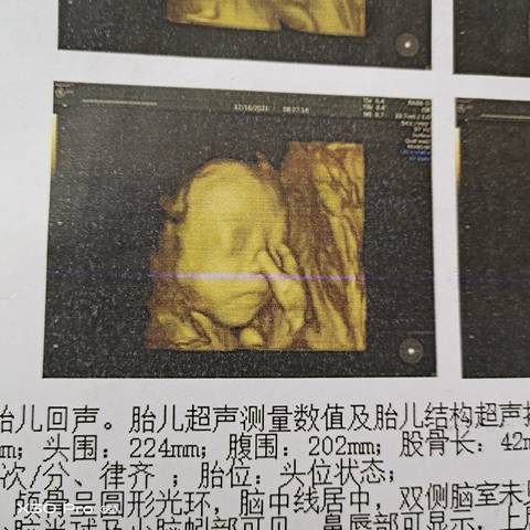 journal_insert_pic_1683374029