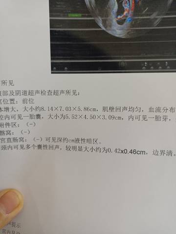 journal_insert_pic_1676593333