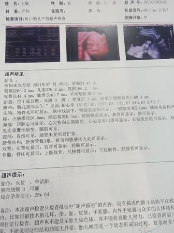 journal_insert_pic_1684191375