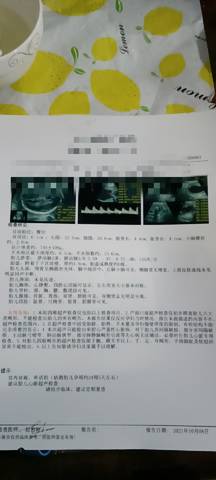 journal_insert_pic_1681831681