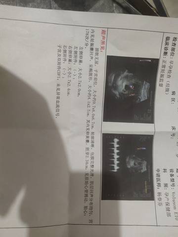 journal_insert_pic_1682131977