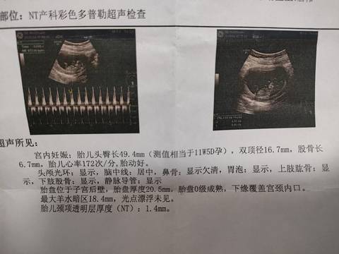 journal_insert_pic_1674120959