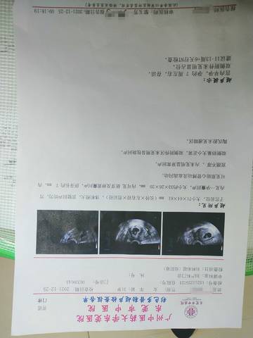 journal_insert_pic_1685777570