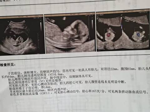 journal_insert_pic_1673900263