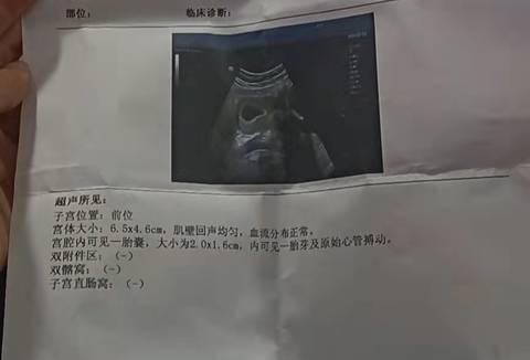 journal_insert_pic_1682116537
