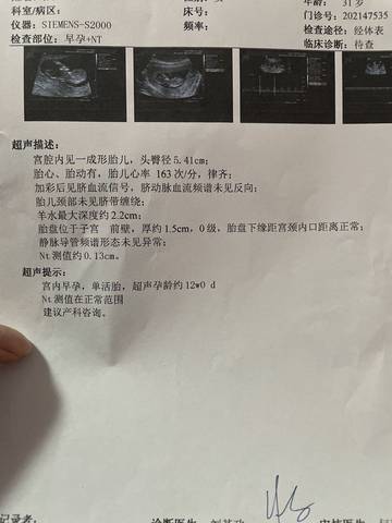 journal_insert_pic_1678133127