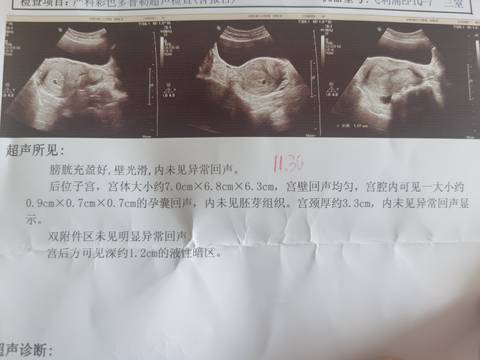 journal_insert_pic_1677534436