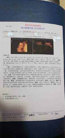 journal_insert_pic_1677585289