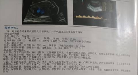 journal_insert_pic_1685510977