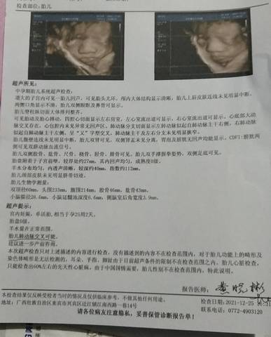 journal_insert_pic_1686057490