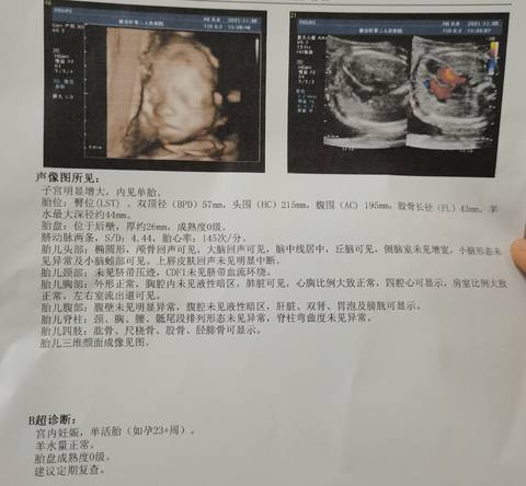 journal_insert_pic_1673865817