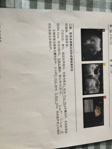 journal_insert_pic_1688794551