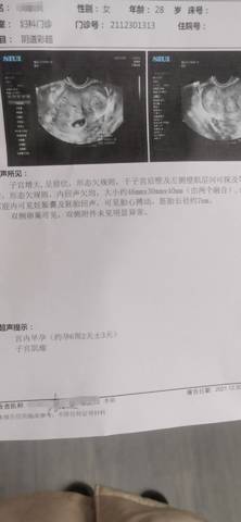 journal_insert_pic_1689059355