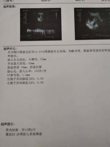 journal_insert_pic_1690156764