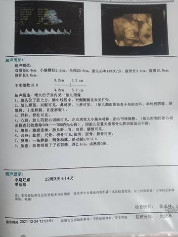 journal_insert_pic_1685326067