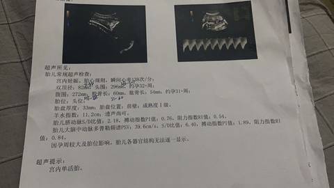 journal_insert_pic_1678331135