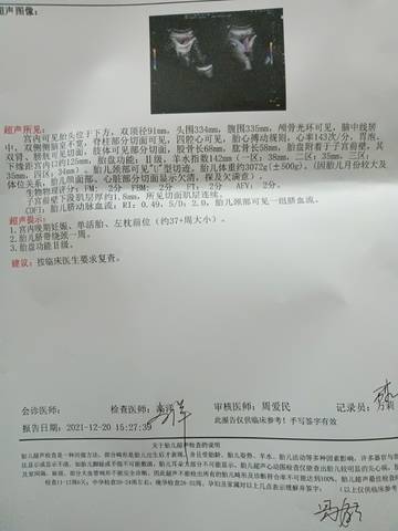 journal_insert_pic_1683187157