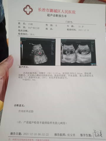 journal_insert_pic_1677243253