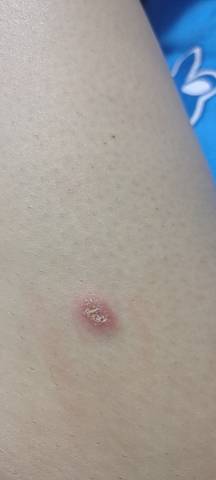 journal_insert_pic_1681655018