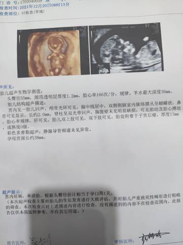 journal_insert_pic_1683011916