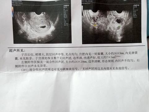 journal_insert_pic_1673892833