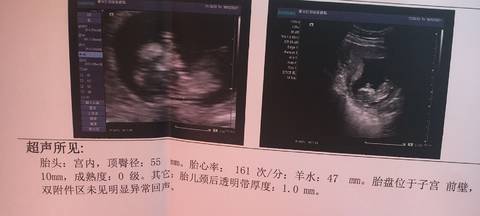 journal_insert_pic_1677697978