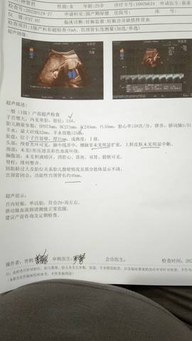 journal_insert_pic_1720026559
