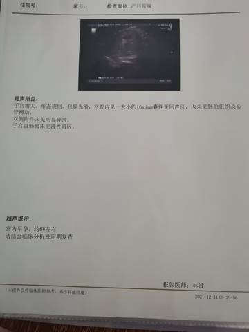 journal_insert_pic_1689721414