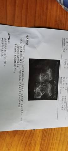 journal_insert_pic_1685693912