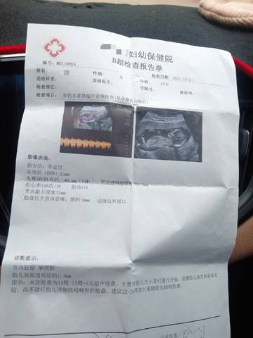 journal_insert_pic_1685121230