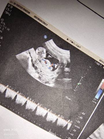 journal_insert_pic_1719926078