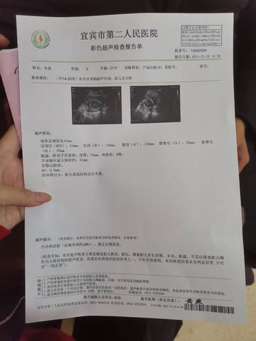 journal_insert_pic_1682051602
