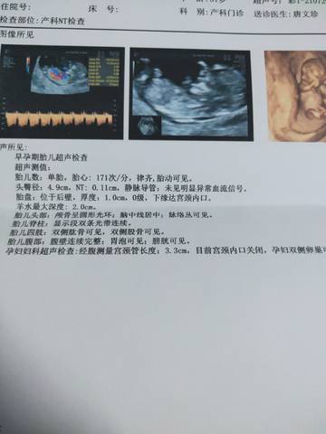 journal_insert_pic_1683456931