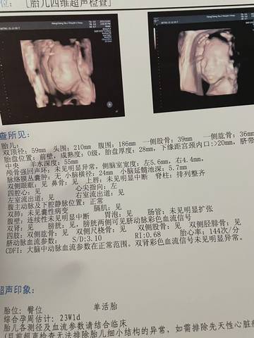 journal_insert_pic_1674814892