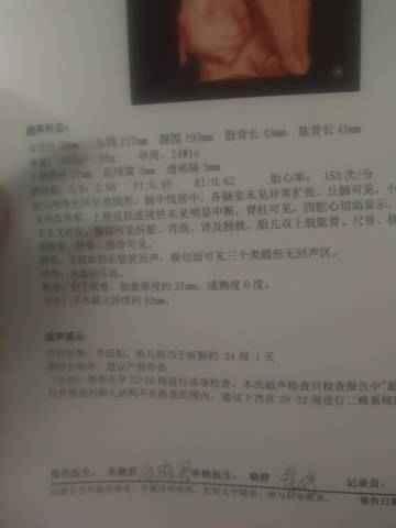 journal_insert_pic_1683253205