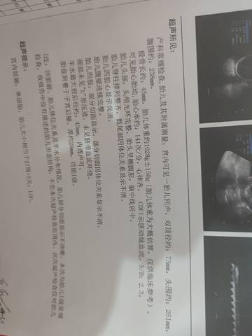 journal_insert_pic_1673118831