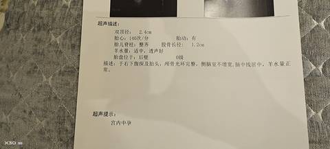 journal_insert_pic_1681621861