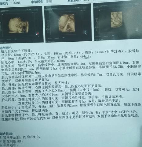 journal_insert_pic_1689105368