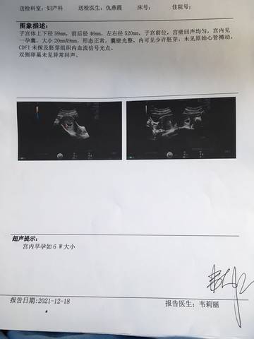 journal_insert_pic_1682073290