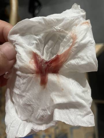 journal_insert_pic_1741020361