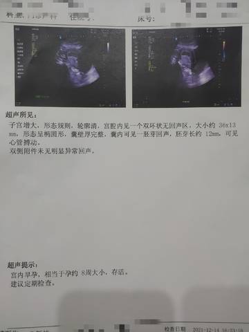 journal_insert_pic_1679999920
