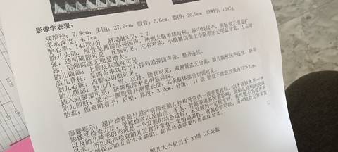 journal_insert_pic_1690029683